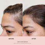 https://cdn.shopify.com/s/files/1/1336/0857/files/02_GRO_Hair-Serum_BA_06.30.25_65d444d1-37e1-401d-a0c6-a7a746749d86.jpg?v=1763710456