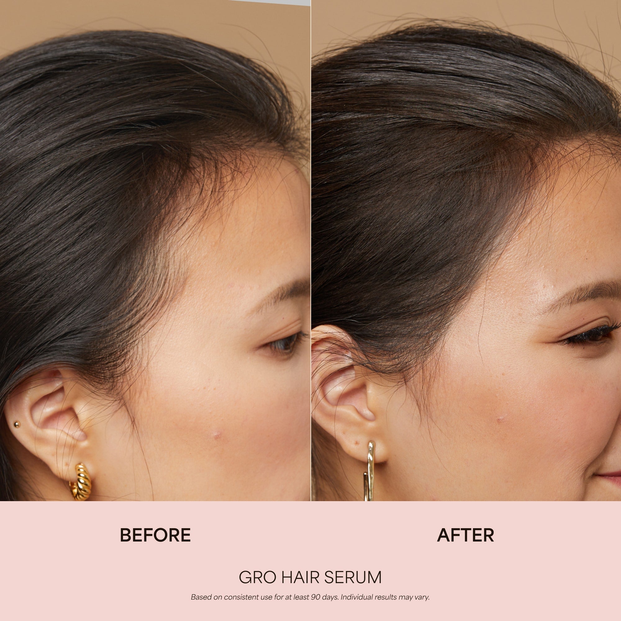 https://cdn.shopify.com/s/files/1/1336/0857/files/03_GRO_Hair-Serum_BA_06.30.25.jpg?v=1763710276
