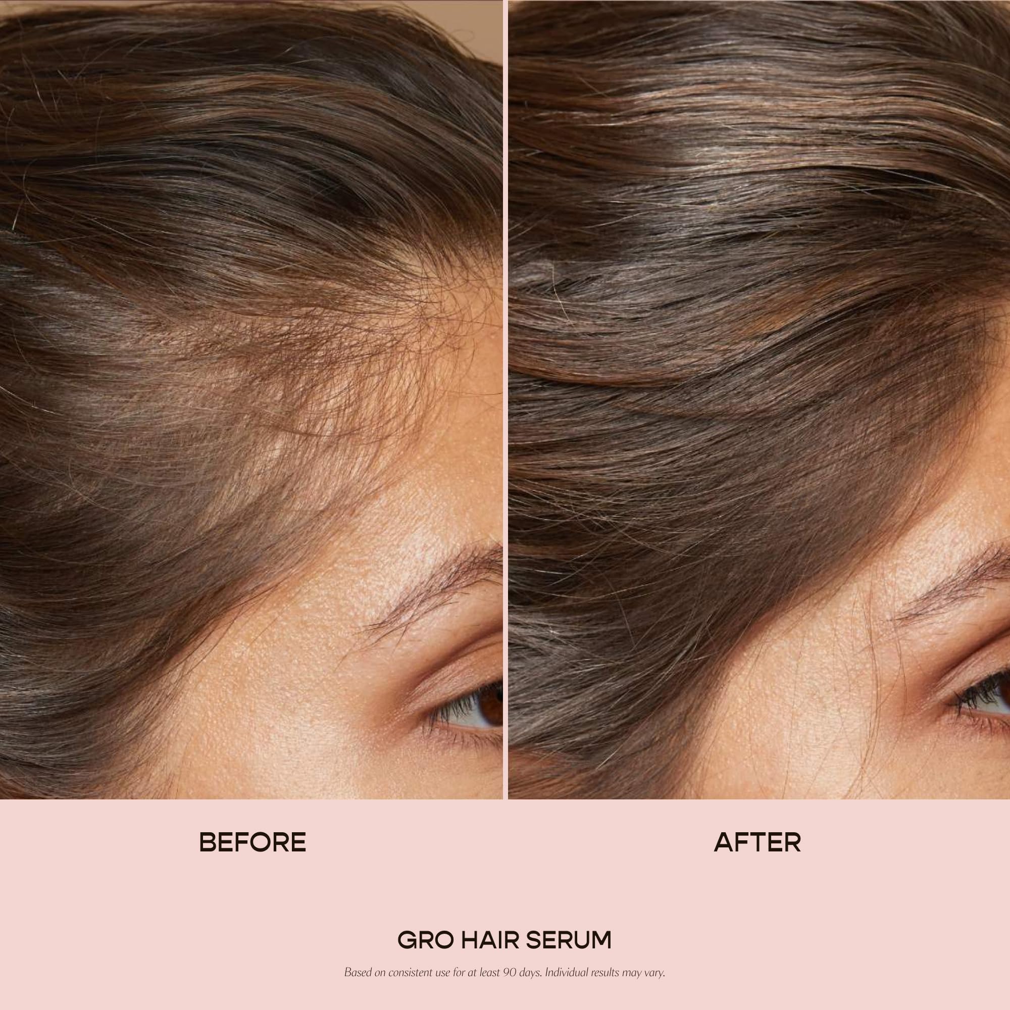 VEGAMOUR GRO Hair Serum for Hair Thinning, Thicker Fuller Looking Hair, Non Oily Serum for Healthier Scalp, 30 day Supply 1.0 fl oz, 1 pack
